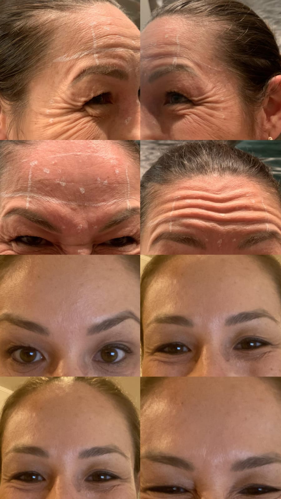 Estética Facial Ipiranga São Paulo | Studio Mary Bessa