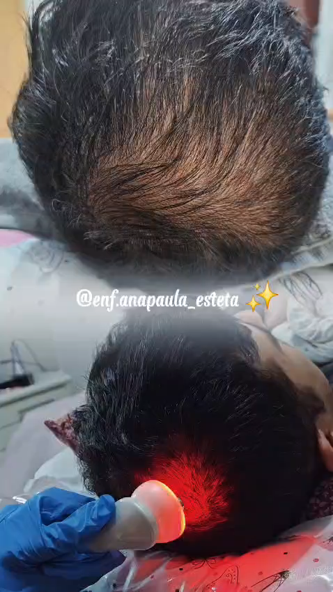 Tratamento Capilar para Queda no Ipiranga | Studio Mary Bessa