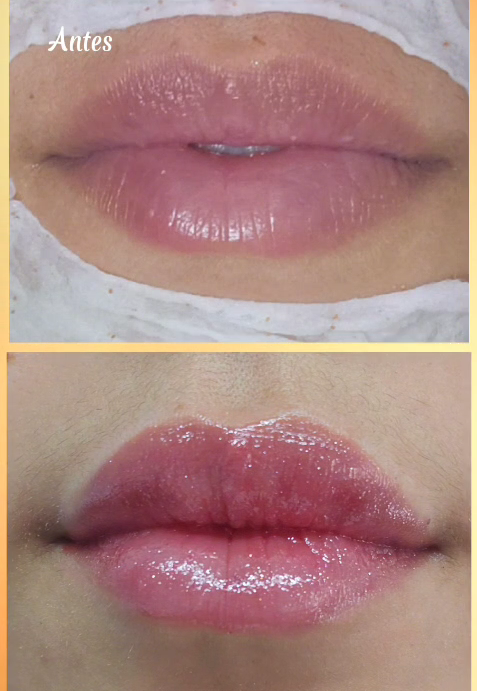 Estética Facial Ipiranga São Paulo | Studio Mary Bessa