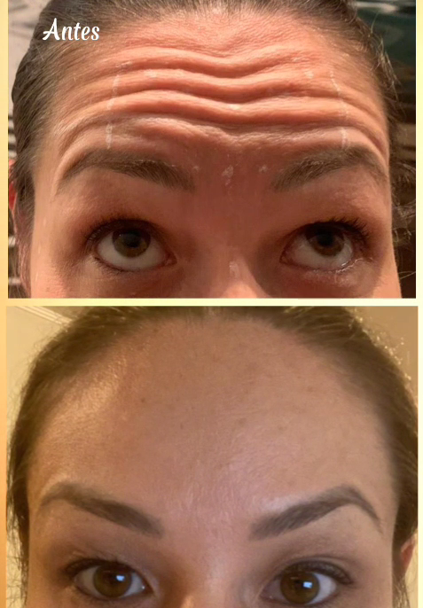 Estética Facial Ipiranga São Paulo | Studio Mary Bessa